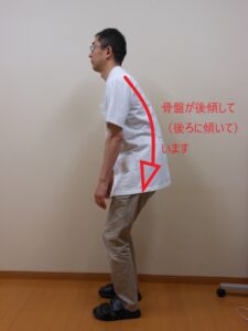 骨盤や背骨のゆがみが自律神経にも関係するという写真です。